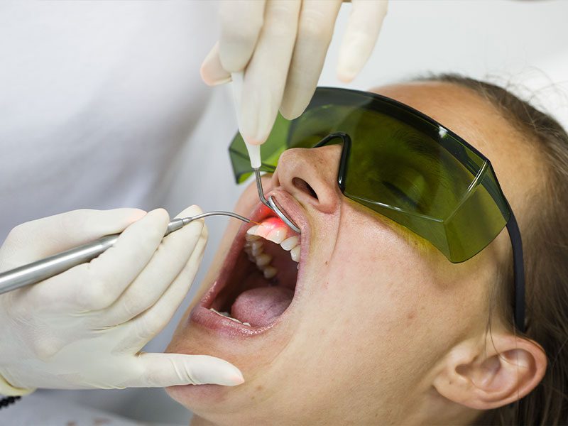 Woman during a periodontal laser therapy procedure